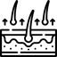 alopecia
