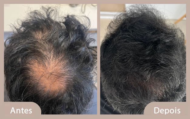 antes e depois 1