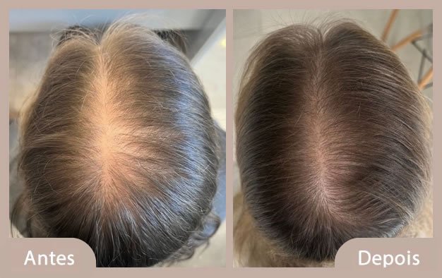 antes e depois 2