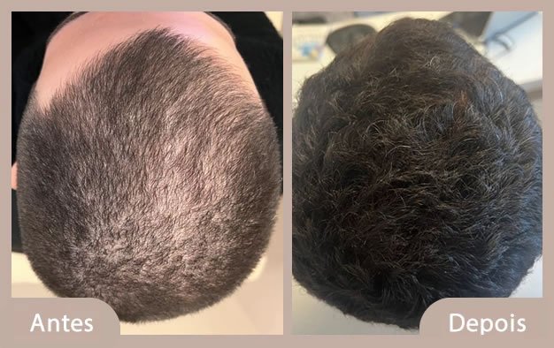 antes e depois 3