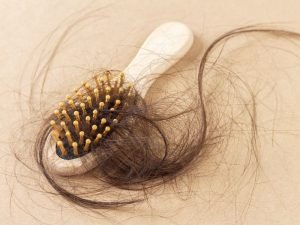 Clínica de queda de cabelo em São Paulo