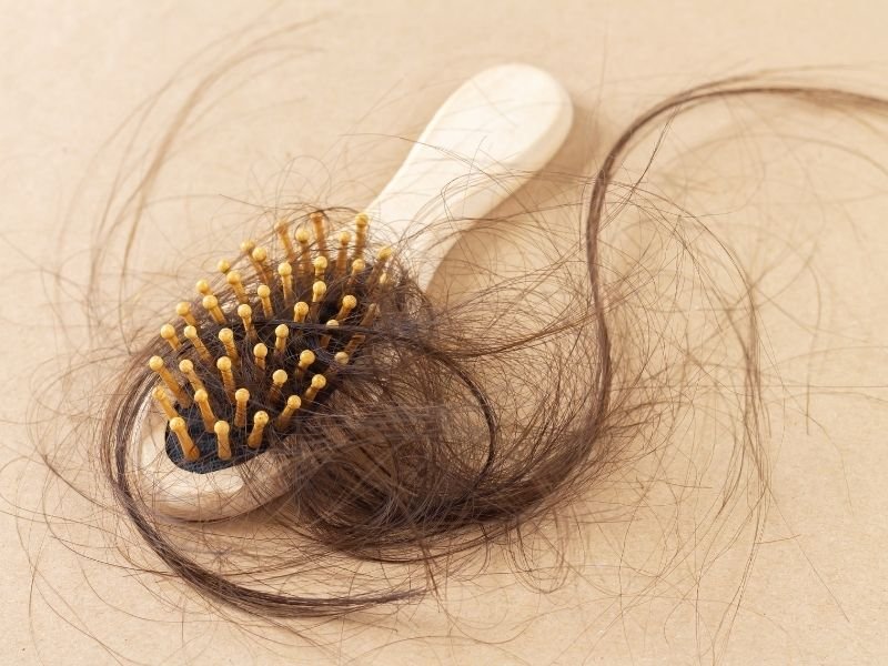 Clínica de queda de cabelo em São Paulo