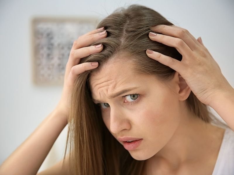 Alopecia androgenética em São Paulo