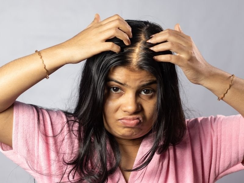 Alopecia androgenética com especialista em São Paulo