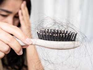 Tratamento de alopecia feminina em São Paulo
