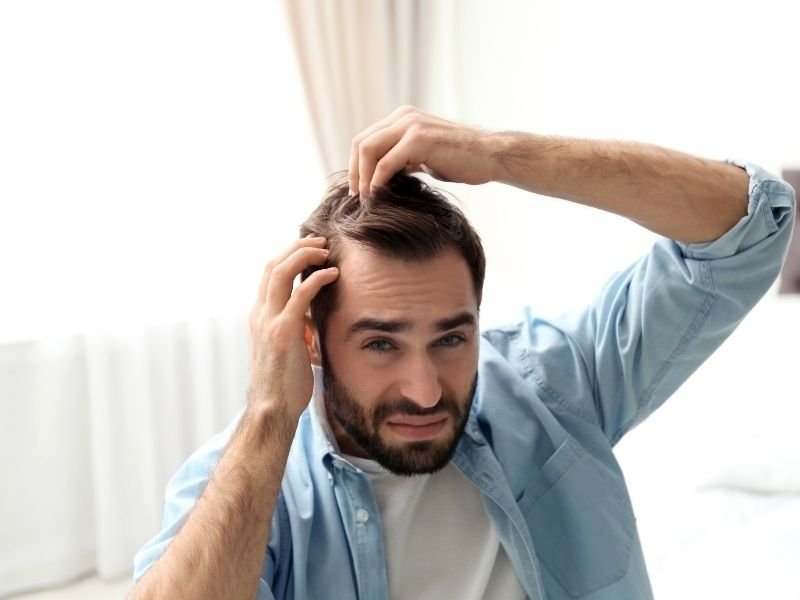 Alopecia areata em São Paulo