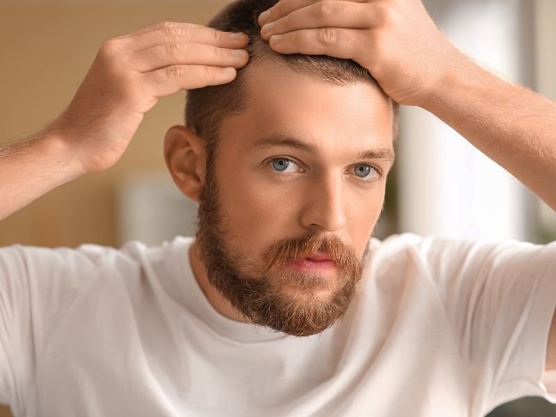 Calvície masculina em São Paulo