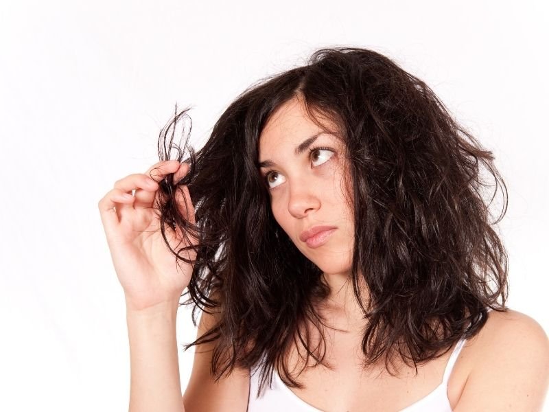 Alopecia cicatricial em São Paulo
