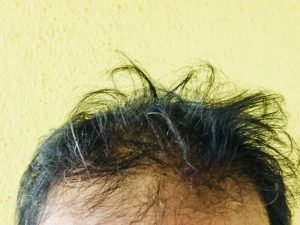 Tricodinia em São Paulo
