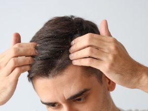 Clínica de dermatite seborreica em São Paulo