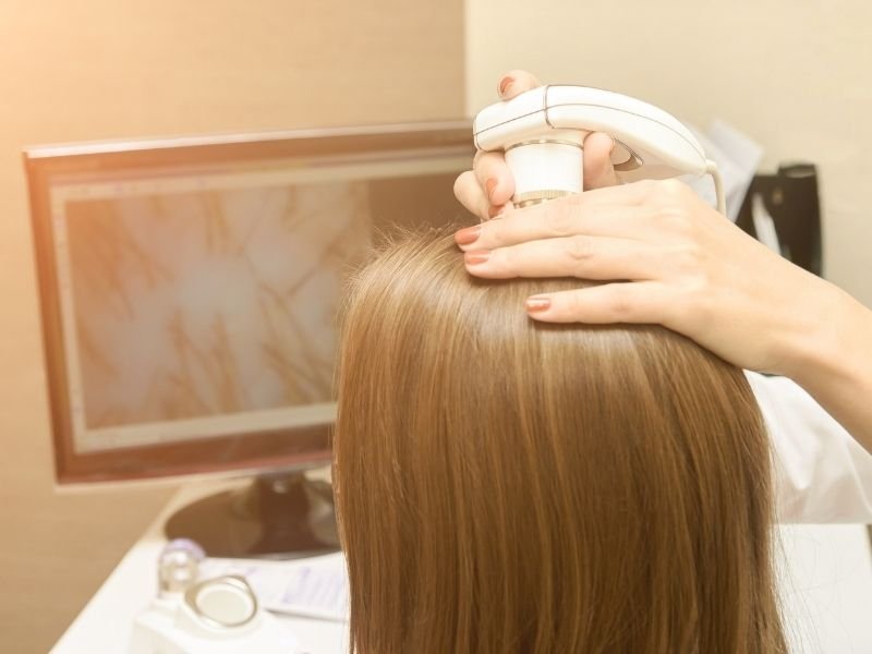 Terapia com laser capilar em São Paulo