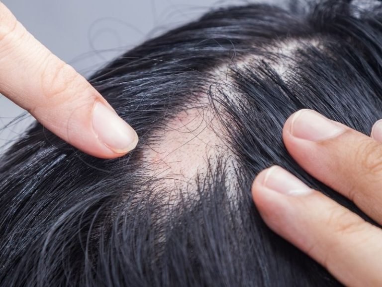 Clínica que trata alopecia em São Paulo
