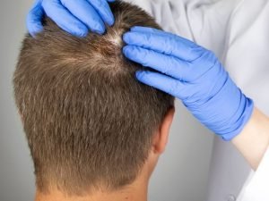 Tratamento com ativos concentrados para o cabelo em São Paulo