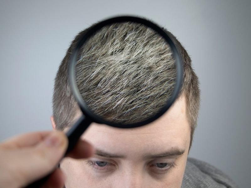Atendimento com foco em saúde capilar masculina em São Paulo
