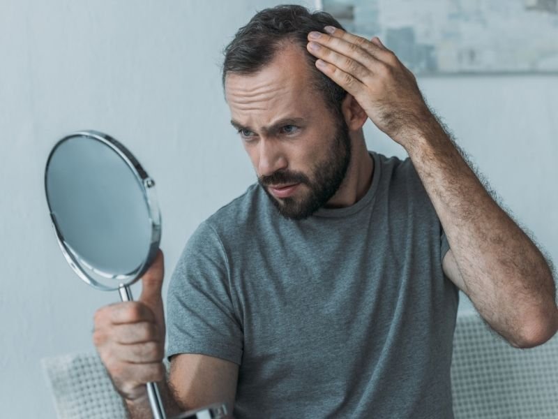 Terapia capilar em homens com calvície em São Paulo