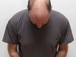 Tricologista em São Paulo: Santo Amaro