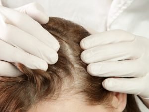 Crescimento de cabelo em São Paulo