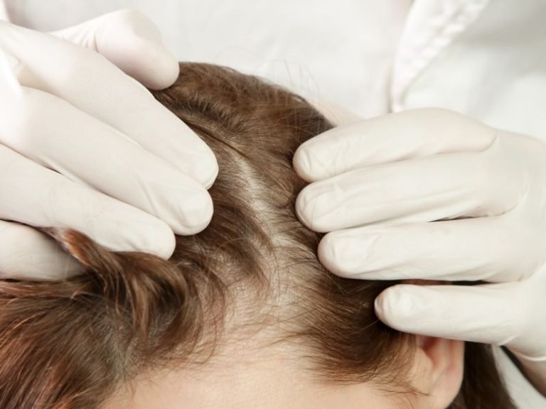 Crescimento de cabelo em São Paulo