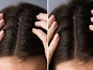 Clínica de crescimento de cabelo em São Paulo