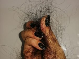 Clínica de estresse e queda capilar em São Paulo