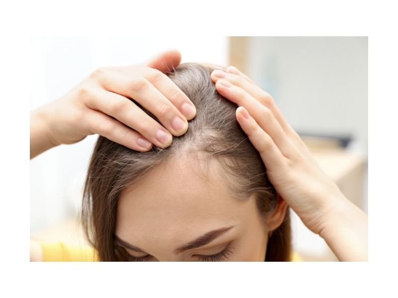 Tricologista para queda de cabelo em São Paulo