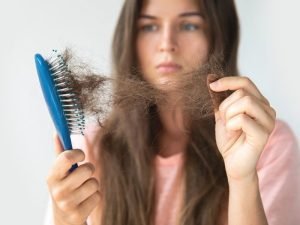 Especialista em queda de cabelo em São Paulo