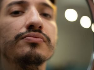 Especialista em falhas na barba em São Paulo
