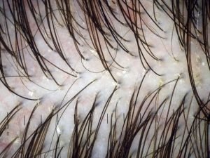 Especialista em LEDterapia capilar em São Paulo