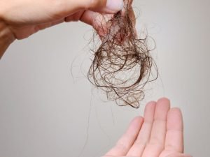 Clínica para queda de cabelo em São Paulo