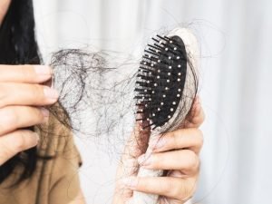 Soluções para queda de cabelo em São Paulo