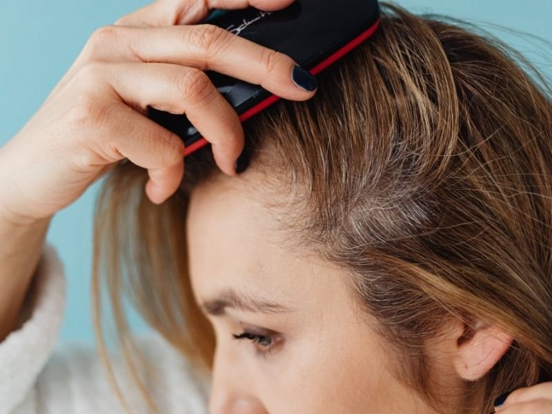 Alopecia em São Paulo